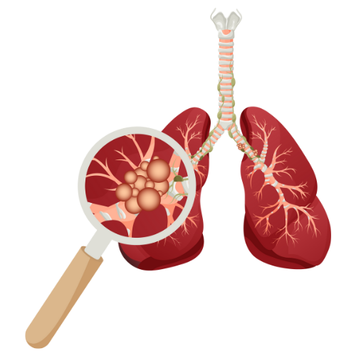 Lung treatment