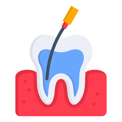 Root Canal Treatment