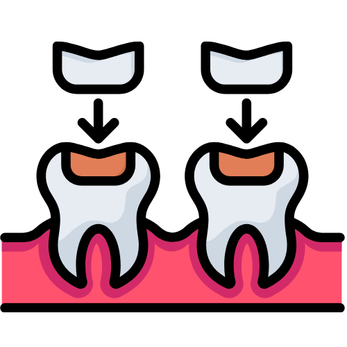 Dental Fillings
