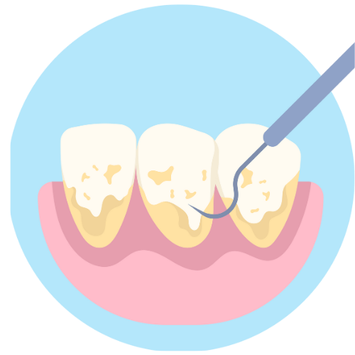 Teeth Cleaning