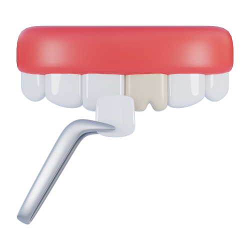 Dental Veneers